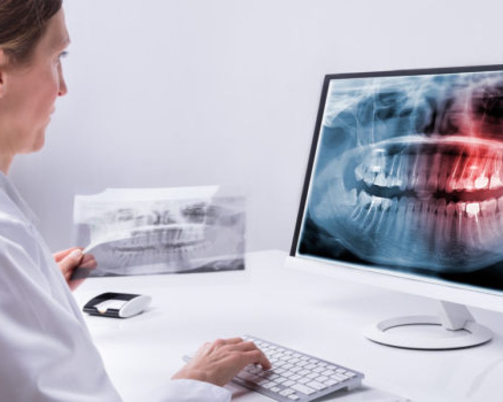 Czym jest skaner wewnątrzustny i jakie ma zastosowanie w stomatologii?