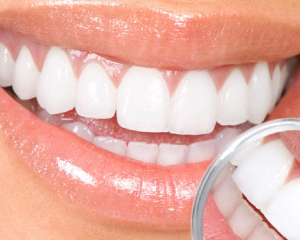 Najpopularniejsze metody wybielania zębów